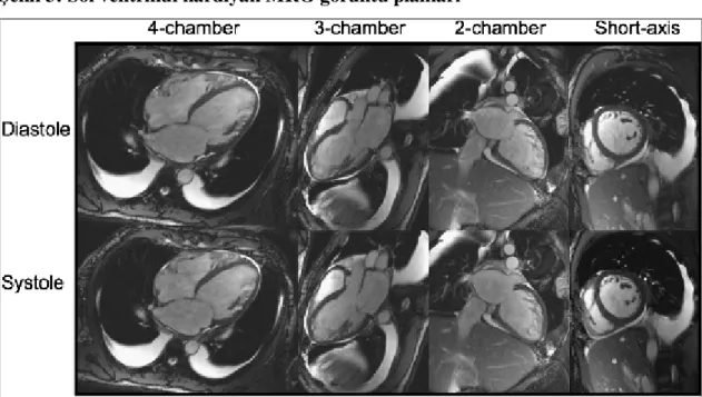 Şekil 3: Sol ventrikül kardiyak MRG görüntü planları 