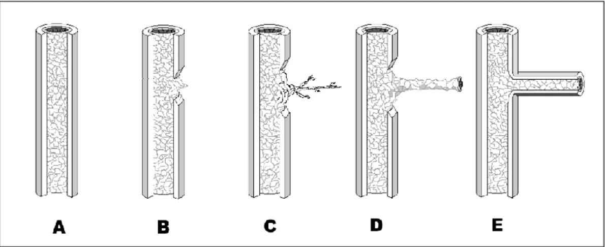 ġekil 2. Anjiogenez basamakları A- Mural doku (bazal membran, perisitler ve adventisya) ile  çevrili  tek  tabaka  endotelden  oluĢan  stabil  damar  yapısı  B  –  Endotel  hücreleri  tarafından  mural  dokunun  parçalanması  C–  Endotel  hücrelerin  periv