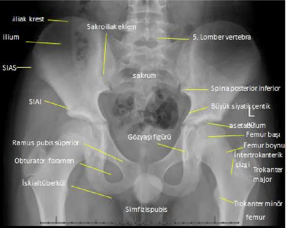 Şekil 4: Pelvisin Radyolojik Anatomisi