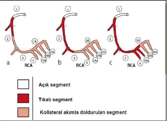 Şekil 5: Tam tıkalı segment uzunluğunun değerlendirilmesi 
