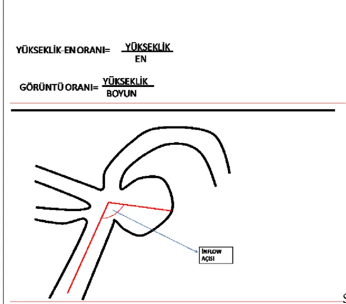 Şekil 12:Anevrizma giriş açısı 