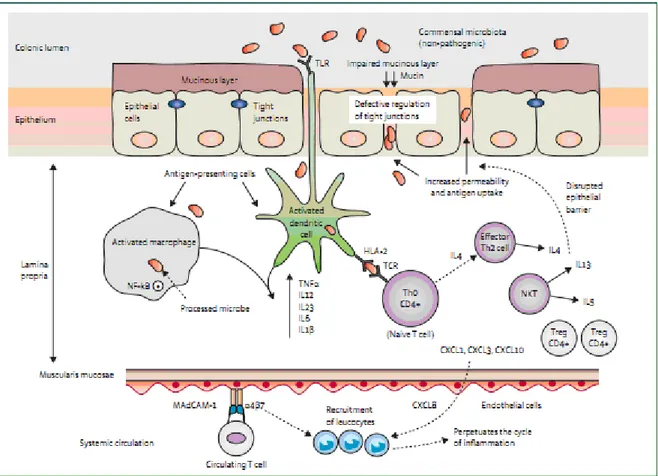 Şekil  2:  ÜK Patofizyolojisi (TLR-Toll-like receptor. HLA-human leucocyte antigen. IL-
