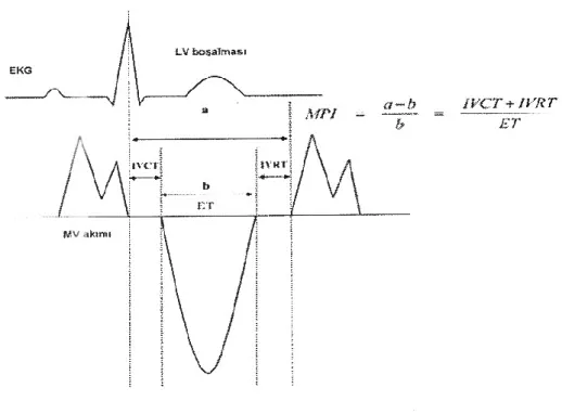 Şekil 3. Pulsed Doppler ekokardiyografi ile MPİ ölçümü 