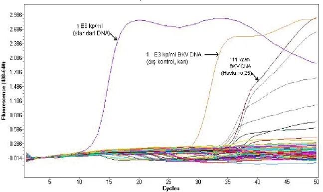 Şekil 5: Kandaki BKV DNA pozitifliğini gösteren amplifikasyon  eğrisi. ( E=10 X )