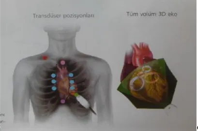 Şekil  4.  Canlı  3B-EKO  ile  tek  seferde  kalbin  tamamının  görüntüsünü  elde  etmek  için kullanılan transdüser pozisyonu