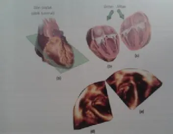 Şekil 9. Koronal (frontal) kesit yardımıyla kalp aşağıdan ya da yukarıdan incelenebilir