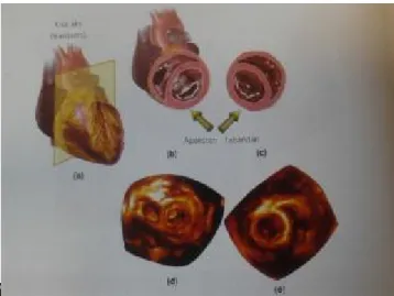 Şekil  10.  Transvers  kesitte  kalp  kısa  eksende  apikal  ya  da  bazal  perspektifden  görüntülenebilir