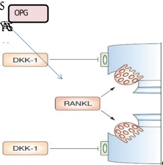 Şekil 4: RANKL ile OPG ve DKK-1 ilişkisi  