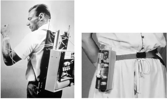 Şekil 1 1970 yıllardaki insülin infüzyon pompa tasarımları 