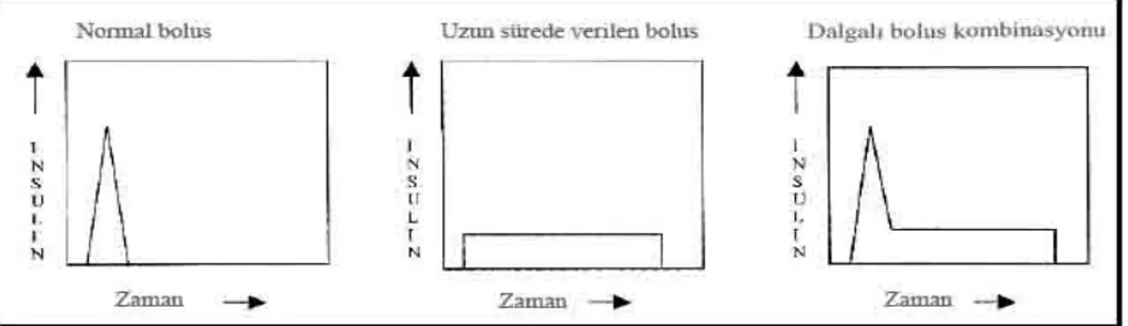 Şekil 2 İnsülin bolus dalgaları (9)