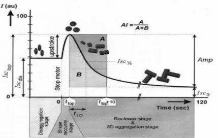 Şekil 2. Agregasyon ölçümü sırasında kaydedilen bir silektogramın şematik görüntüsünde önce  yüksek  hızda,  sonra  durdurulduğunda  elde  edilen  kayıt  değişimi  izlenmektedir