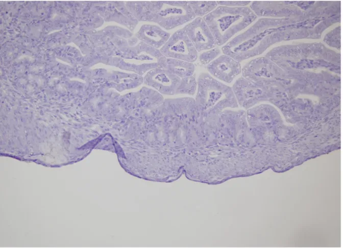 Şekil 3: Özefagus atrezili rat fetüs özefagus dokusunun C-kit boyasında, İCH’ler kas tabakası 