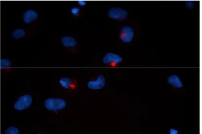 Şekil 1.     HisMax-STAMP1-transfekte PC3 hücreleri  