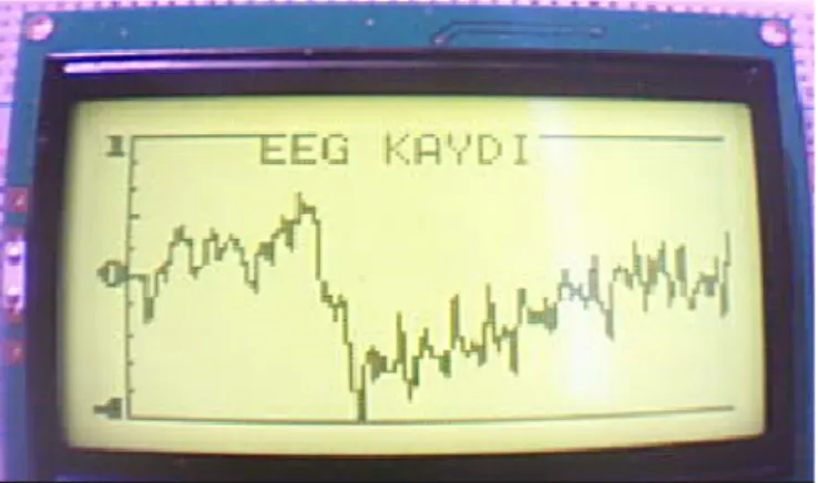 Şekil 2. LCD’de çizdirilmiş örnek bir EEG kayıdı 