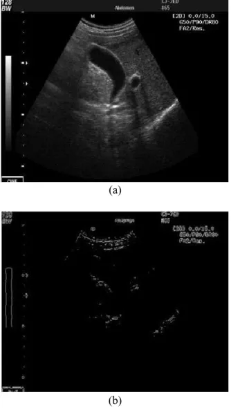 Şekil 1. (a) Başlagıç safra kesesi ses üstü imgesi, (b) başlangıç ses üstü imgesine ayrıt sezimi  algoritması uygulandıktan sonra elde edilen imge 