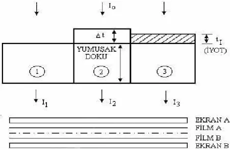 Şekil 1. Klasik radyografide görüntüleme 