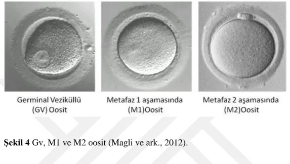 ġekil 4 Gv, M1 ve M2 oosit (Magli ve ark., 2012). 