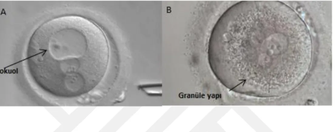 ġekil 7 Vokuol ve granüle yapıya sahip embriyo  A. Saat 12 yönünde vokuol yapısı.    B