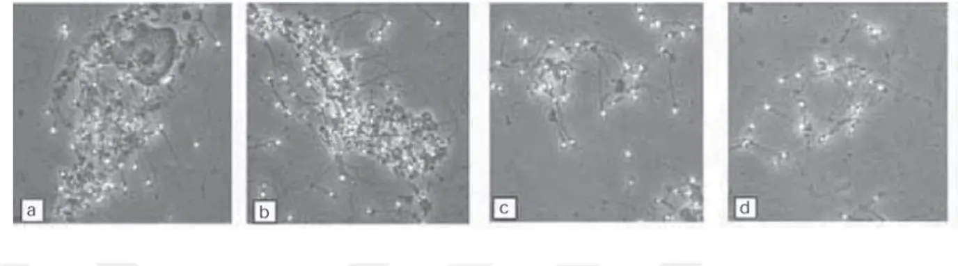 Şekil  8:  Bir  epitel  hücresi  (a),  debris  (b)  veya  spermatozoa  (c,  d)  ile  kümeleşmiş  spermatozoa görüntüleri(WHO 5.baskı, 2010)
