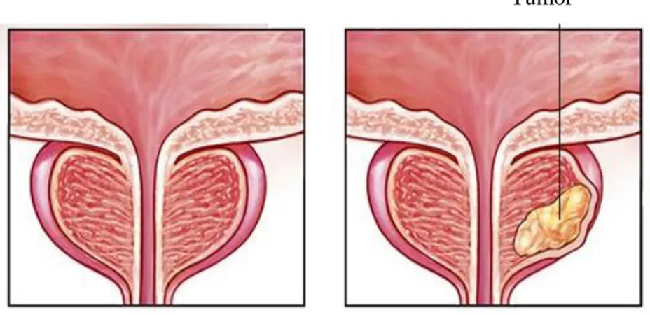 Figure 1. Prostate gland     