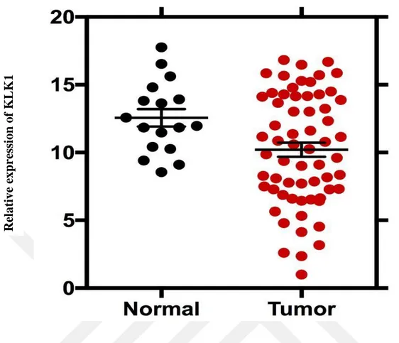 Figure  7.  KLK1  gene  expression  levels  in  normal  and  tumor  tissues.  KLK1  Gene  expression levels of prostate cancer is relatively lower than in normal tissues