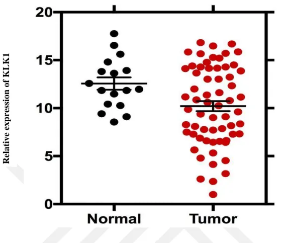 Figure  7.  KLK1  gene  expression  levels  in  normal  and  tumor  tissues.  KLK1  Gene  expression levels of prostate cancer is relatively lower than in normal tissues
