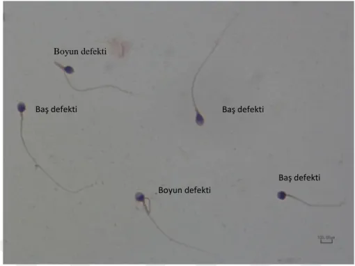 Şekil  8:  Sperm  morfoloji  değerlendirmesi,  anormal  morfolojik  yapıdaki  spermlerin  gösterimi (100x immersiyon objeksifi ışık mikroskobu görüntüsü) 