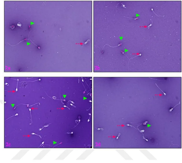 Şekil 6. Eosin Y ile Boyanmış Spermatozoon 