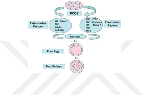 Şekil 2.3.1: PKOS’li bireylerde IVF başarısını olumsuz yönde etkileyen faktörler (Qiao 