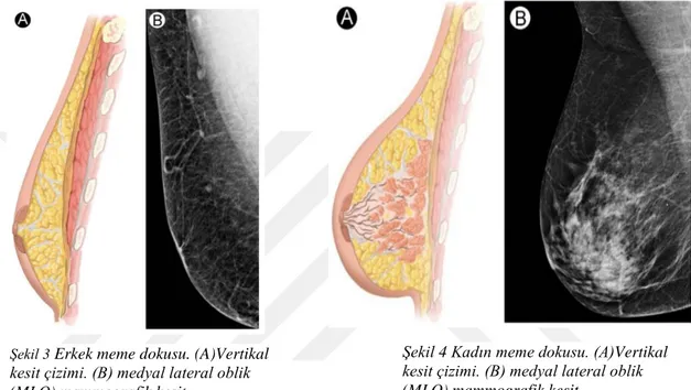 Şekil 4 Kadın meme dokusu. (A)Vertikal  kesit çizimi. (B) medyal lateral oblik  (MLO) mammografik kesit