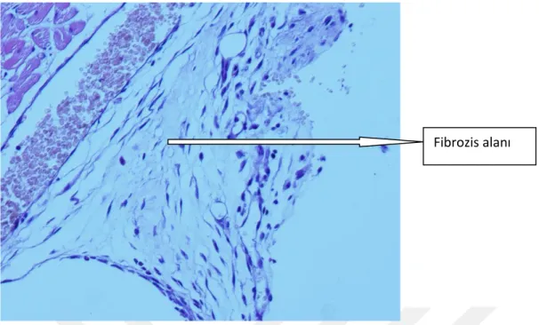 Şekil 14: Orta düzeyde fibrozis içeren grade-2 düzeyinde adezyonun histopatolojik görüntüsü  (Keten tohumu yağı grubundan bir örnek) 