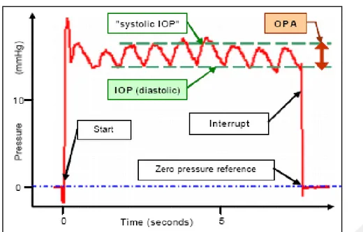 Fig. 8:OPA’nın ölçüm prensibi 
