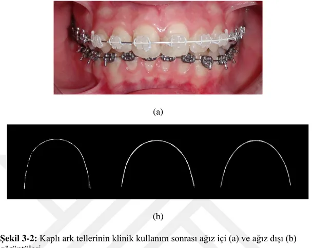 Şekil 3-2: Kaplı ark tellerinin klinik kullanım sonrası ağız içi (a) ve ağız dışı (b)  görüntüleri