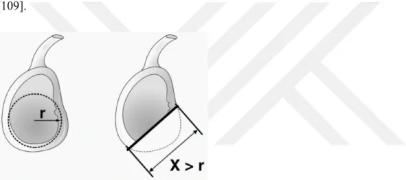 Şekil 20: Gerber indeksi, X&gt;r ise çıkık oluşturacak kuvvet %70 azalır [110]  