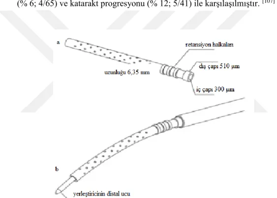 Şekil 9. CyPass implantı a) implantın görünümü,uzunluğu ve çapları               b)Yerleştirici aletin görünümü  (120)