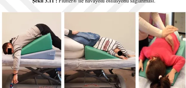 Şekil 3.12 : Postural drenaj ve perküsyon; 45 o