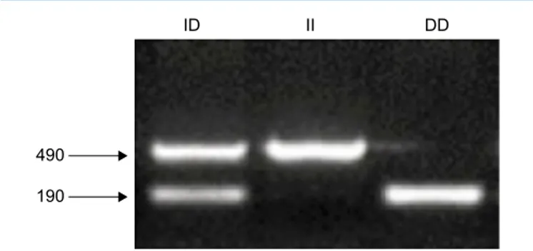 Figure 2. Agarose gel images of ACE polymorphisms.