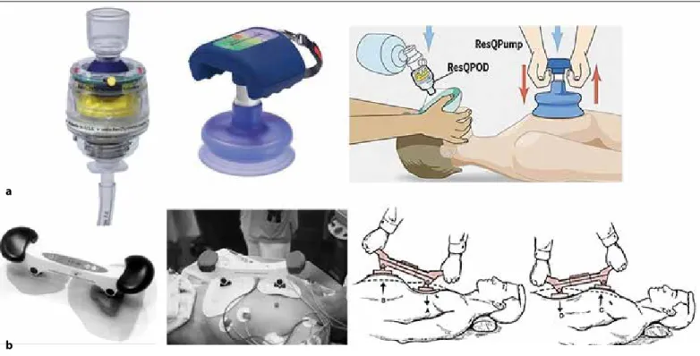 Figure 5. a, b. Other CPR devices. (a) Impedance threshold device (ITD) and ResQCPR: ResQPod+ResQPump (46)