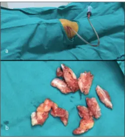 Figure  3:  Image  showing  clinical  appearance  of  the