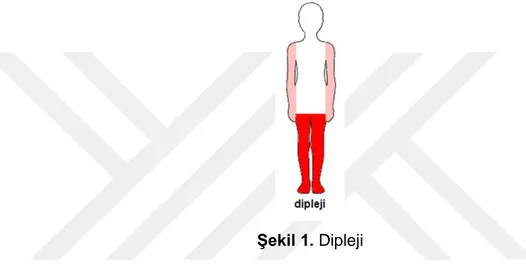 Şekil 1. Dipleji 