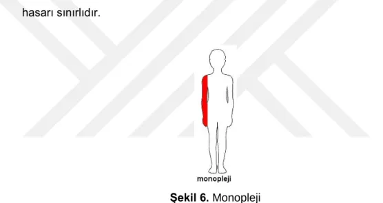 Şekil 5. Tripleji 