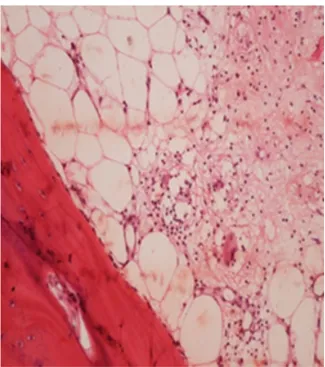 Fig. 8 Nonnecrotizing histiocytic granulomatous lesion (200 he- he-matoxylin and eosin stain).