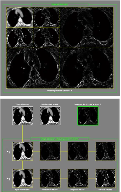 Figure 2.3: Two-Level DWT Decomposition a) LF x  &amp; HF x  images b) Two-Level Decompositions 