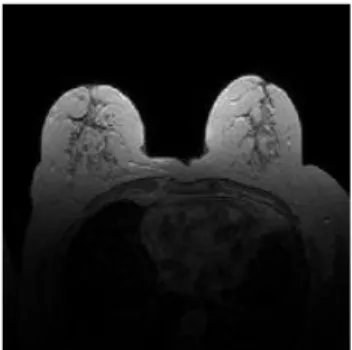 Figure 2.7  shows an example dicom file. The following information is about the  dicom file