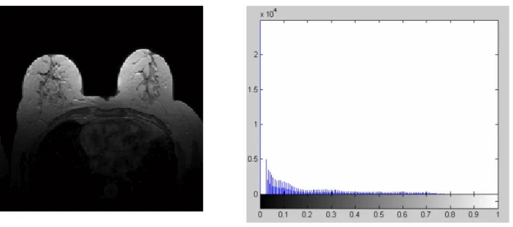 Fig. 3.10 An experimental image and corresponding histogram of  experimental image 