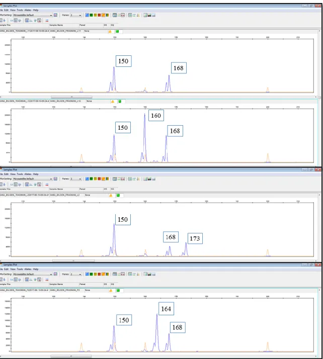 Şekil 3.9. OVK036 no'lu primere ait allellerin GeneMapper Software 5.0 (Applied Biosystems)  programındaki görüntüsü 