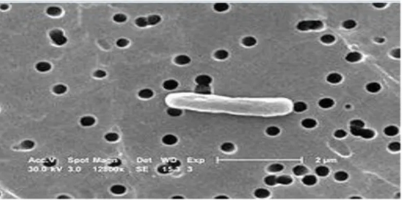 Şekil 2.7. E. coli bakterisinin elektron mikroskobunda görüntüsü (Anonim 2015c) 