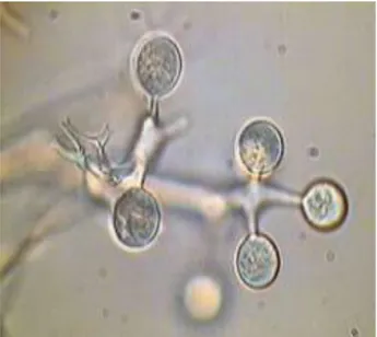 Şekil 1.4. Plasmopara halstedii zoosporangiumları (Zoosporangia) 