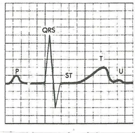 Şekil  2.1:  P  Dalgası  atriyal  repolarizasyonu  gösterir.  PR  intervali  atriyumların  ilk  uyarılmasından  ventriküllerin  ilk  uyarılmasına  kadar  olan  süredir