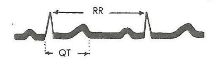 Şekil  2.8:  QT  intervalinin  ölçümü.  RR  aralığı  iki  peş  peşe  Rdalgasının  arasındaki  intervaldir  (Goldberger 2008)